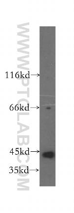 PHKG1 Antibody in Western Blot (WB)