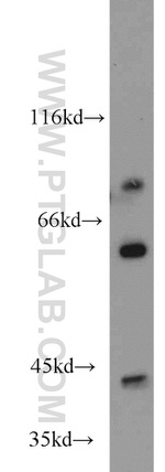 PHKG1 Antibody in Western Blot (WB)