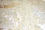 IL15RA Antibody in Immunohistochemistry (Paraffin) (IHC (P))