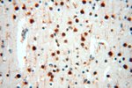 IL15RA Antibody in Immunohistochemistry (Paraffin) (IHC (P))