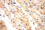 IL15RA Antibody in Immunohistochemistry (Paraffin) (IHC (P))