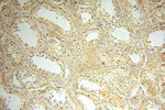 IL15RA Antibody in Immunohistochemistry (Paraffin) (IHC (P))