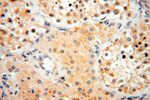 IL15RA Antibody in Immunohistochemistry (Paraffin) (IHC (P))