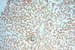 IL15RA Antibody in Immunohistochemistry (Paraffin) (IHC (P))