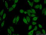 SPOP Antibody in Immunocytochemistry (ICC/IF)