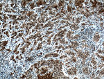 SPOP Antibody in Immunohistochemistry (Paraffin) (IHC (P))