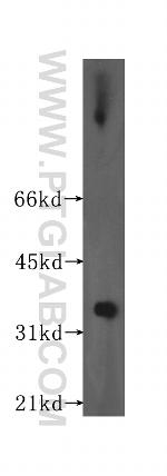 HSD17B8 Antibody in Western Blot (WB)