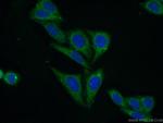 PCK1 Antibody in Immunocytochemistry (ICC/IF)