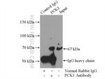 PCK1 Antibody in Immunoprecipitation (IP)