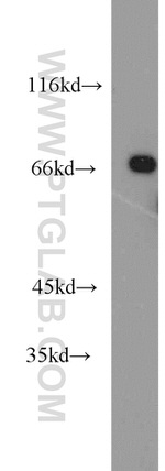 PCK1 Antibody in Western Blot (WB)