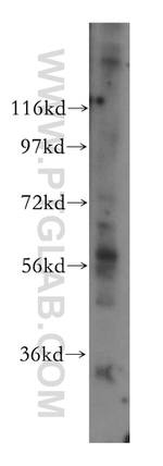 GPT2 Antibody in Western Blot (WB)