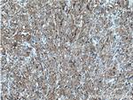 GSTM4 Antibody in Immunohistochemistry (Paraffin) (IHC (P))