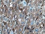 GSTM4 Antibody in Immunohistochemistry (Paraffin) (IHC (P))