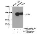 GSTM4 Antibody in Immunoprecipitation (IP)