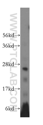 GSTM4 Antibody in Western Blot (WB)