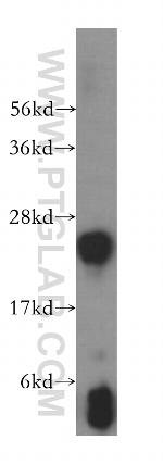 GSTM4 Antibody in Western Blot (WB)