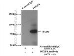 FOXP4 Antibody in Immunoprecipitation (IP)