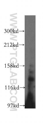 SCUBE3 Antibody in Western Blot (WB)