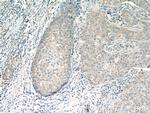 RAB11FIP1 Antibody in Immunohistochemistry (Paraffin) (IHC (P))