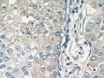 RAB11FIP1 Antibody in Immunohistochemistry (Paraffin) (IHC (P))