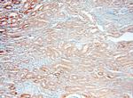 DcR2 Antibody in Immunohistochemistry (Paraffin) (IHC (P))