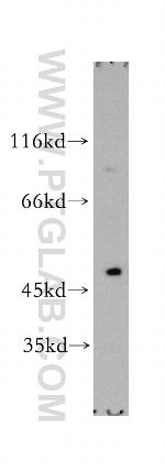 DcR2 Antibody in Western Blot (WB)