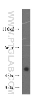 DcR2 Antibody in Western Blot (WB)