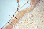 LACTB2 Antibody in Immunohistochemistry (Paraffin) (IHC (P))