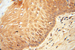 LACTB2 Antibody in Immunohistochemistry (Paraffin) (IHC (P))