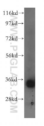 ACY3 Antibody in Western Blot (WB)