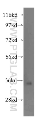 GLOD4 Antibody in Western Blot (WB)