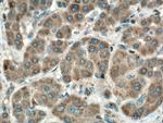 PRPSAP1 Antibody in Immunohistochemistry (Paraffin) (IHC (P))