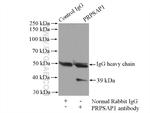 PRPSAP1 Antibody in Immunoprecipitation (IP)