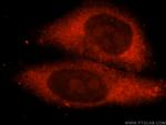 METTL5 Antibody in Immunocytochemistry (ICC/IF)