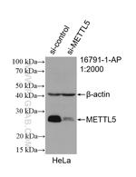 METTL5 Antibody in Western Blot (WB)