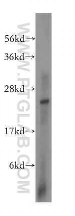 METTL5 Antibody in Western Blot (WB)