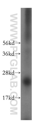 METTL5 Antibody in Western Blot (WB)