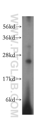 METTL5 Antibody in Western Blot (WB)