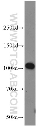 MPP8 Antibody in Western Blot (WB)