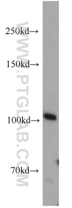 MPP8 Antibody in Western Blot (WB)