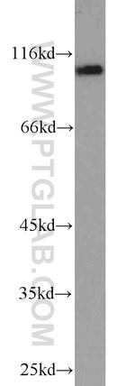 MPP8 Antibody in Western Blot (WB)