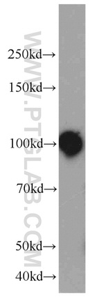 MPP8 Antibody in Western Blot (WB)