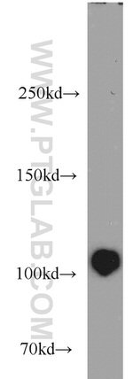 MPP8 Antibody in Western Blot (WB)