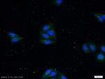 IL1 beta Antibody in Immunocytochemistry (ICC/IF)