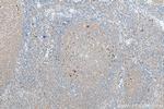 IL1 beta Antibody in Immunohistochemistry (Paraffin) (IHC (P))