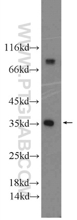 IL1 beta Antibody in Western Blot (WB)