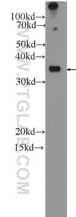 IL1 beta Antibody in Western Blot (WB)