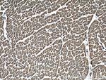 MAGED4 Antibody in Immunohistochemistry (Paraffin) (IHC (P))