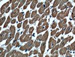 MAGED4 Antibody in Immunohistochemistry (Paraffin) (IHC (P))