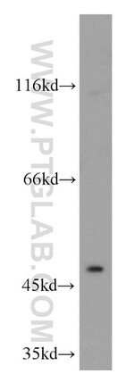 MAGED4 Antibody in Western Blot (WB)